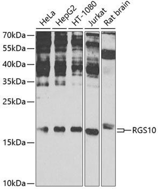 Cell Biology Antibodies 12 Anti-RGS10 Antibody CAB9948