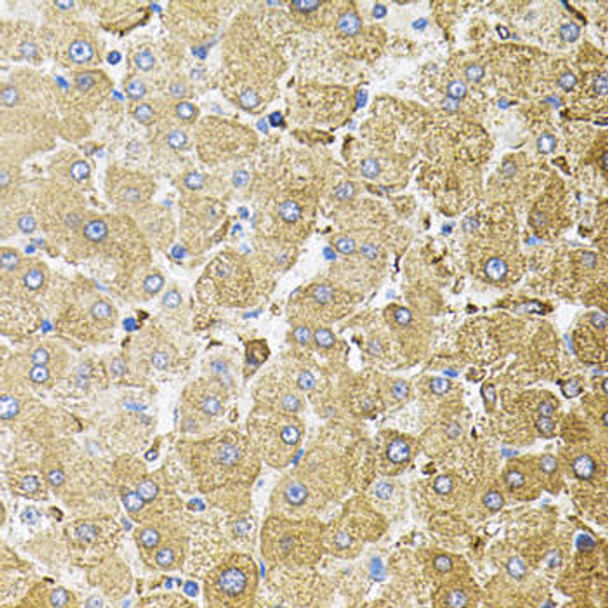 Cell Cycle Antibodies 2 Anti-CEP164 Antibody CAB9964