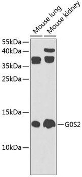 Cell Death Antibodies 2 Anti-G0S2 Antibody CAB9970
