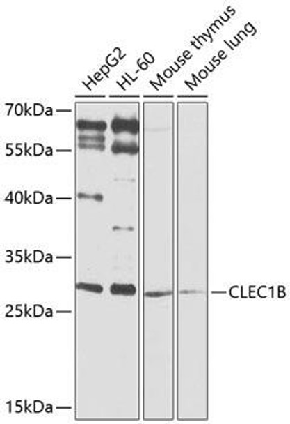 Immunology Antibodies 3 Anti-CLEC1B Antibody CAB9971
