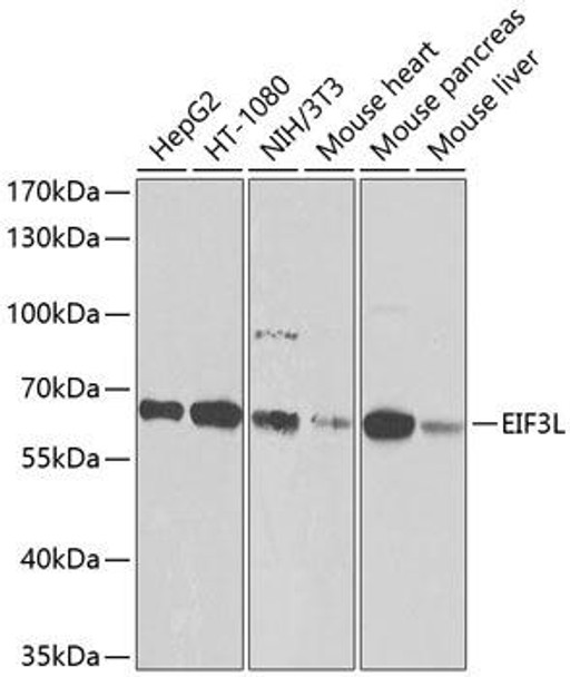 Metabolism Antibodies 3 Anti-EIF3L Antibody CAB9972