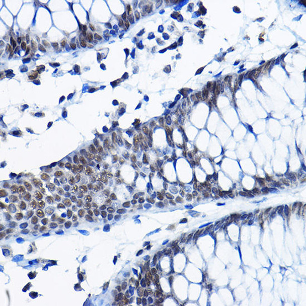 Epigenetics and Nuclear Signaling Antibodies 4 Anti-RPP25 Antibody CAB9973