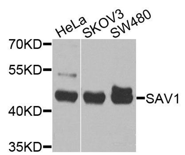Cell Biology Antibodies 16 Anti-SAV1 Antibody CAB9980