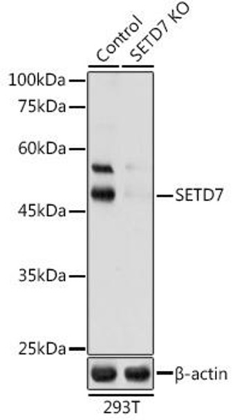 KO Validated Antibodies 1 Anti-SETD7 Antibody CAB9985KO Validated