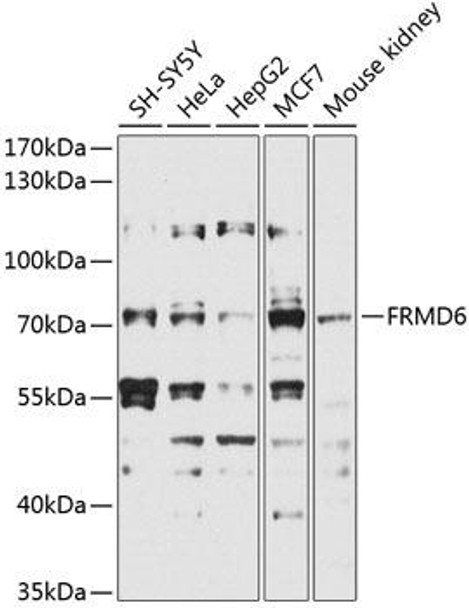 Cell Biology Antibodies 16 Anti-FRMD6 Antibody CAB9995