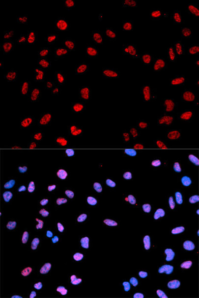 Cell Death Antibodies 2 Anti-Phospho-AKT1-T450 Antibody CABP0004
