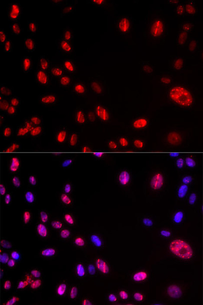 Cell Cycle Antibodies 2 Anti-Phospho-ATM-S1981 Antibody CABP0008