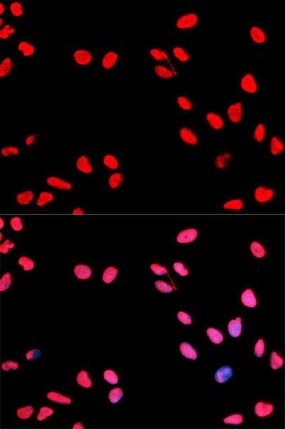 Cell Cycle Antibodies 2 Anti-Phospho-CCNE1-T395 Antibody CABP0013