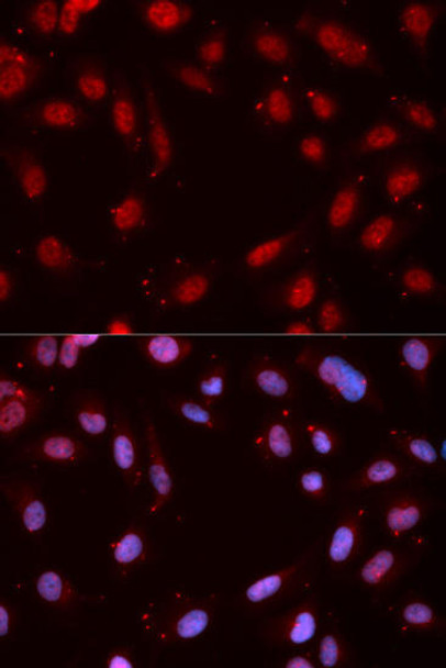Cell Cycle Antibodies 2 Anti-Phospho-CHEK1-S280 Antibody CABP0017