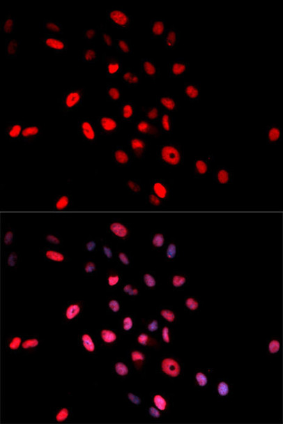 Epigenetics and Nuclear Signaling Antibodies 4 Anti-Phospho-Jun-S63 Antibody CABP0048