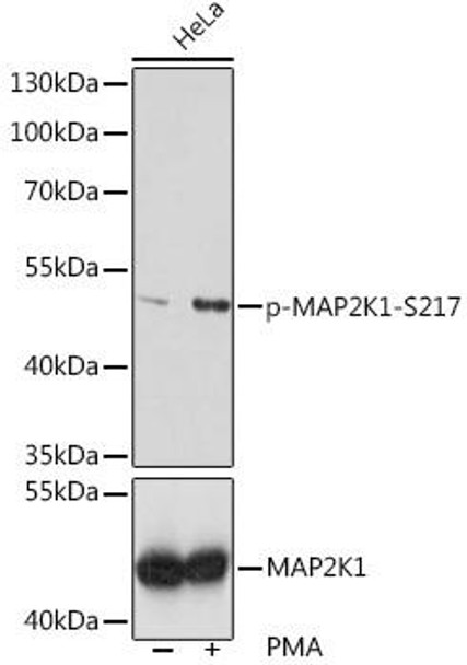 Cell Biology Antibodies 16 Anti-Phospho-MAP2K1-S217 Antibody CABP0062