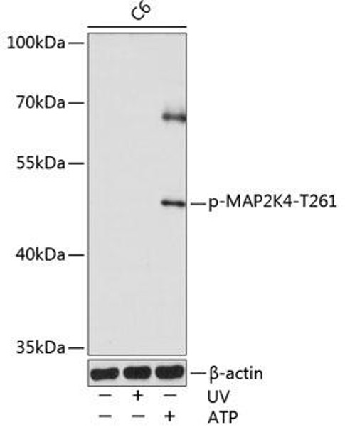 Cell Death Antibodies 2 Anti-Phospho-MAP2K4-T261 Antibody CABP0069