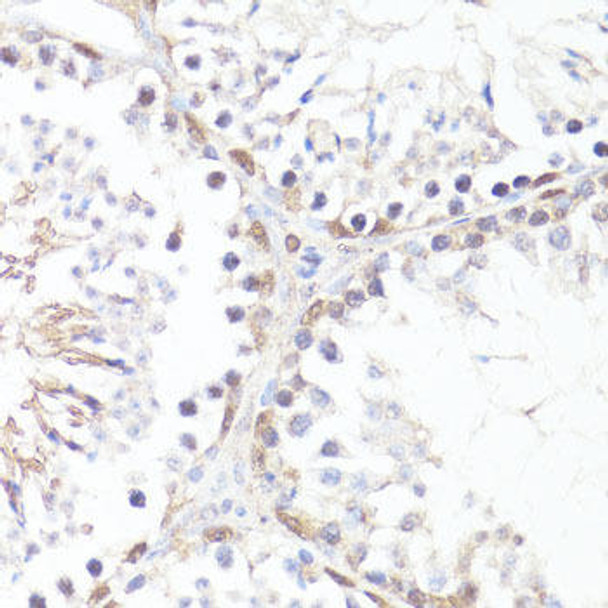 Epigenetics and Nuclear Signaling Antibodies 4 Anti-Phospho-MYC-T58 Antibody CABP0080