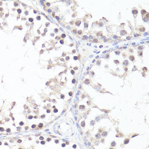 Epigenetics and Nuclear Signaling Antibodies 4 Anti-Phospho-MYC-T58 Antibody CABP0080