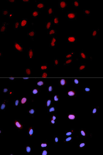 Cell Biology Antibodies 16 Anti-Phospho-MAP2K6-S207/MAP2K3-S189 Antibody CABP0081