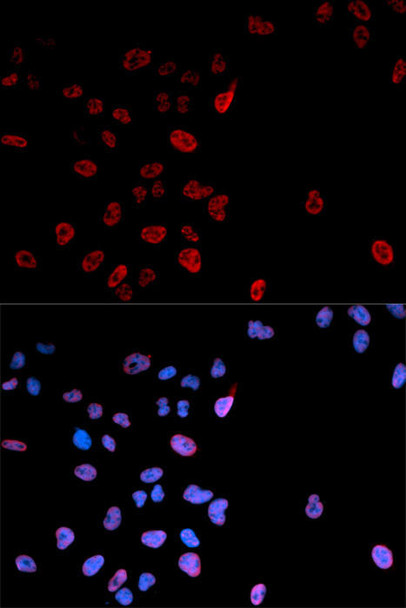 Epigenetics and Nuclear Signaling Antibodies 4 Anti-Phospho-MYC-S62 Antibody CABP0082