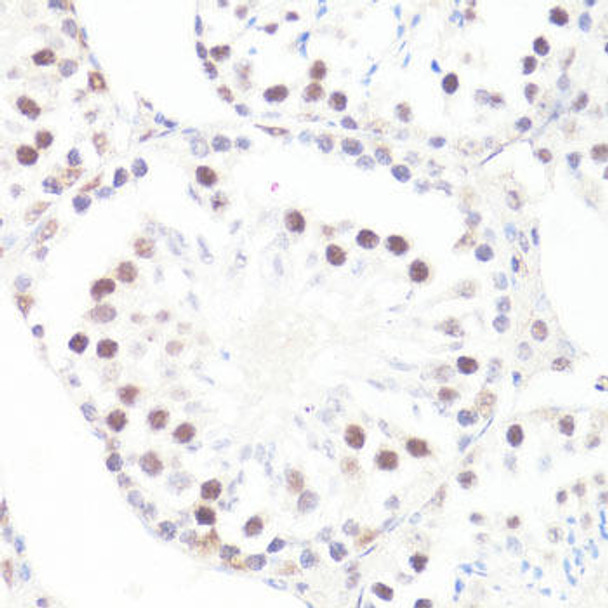 Epigenetics and Nuclear Signaling Antibodies 4 Anti-Phospho-MYC-S62 Antibody CABP0082