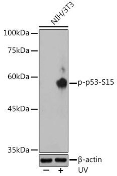 Cell Death Antibodies 2 Anti-Phospho-p53-S15 Antibody CABP0083