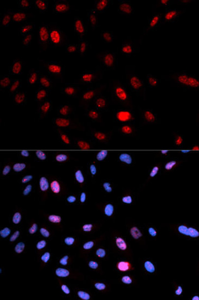 Cell Cycle Antibodies 2 Anti-Phospho-SMC1A-S957 Antibody CABP0090