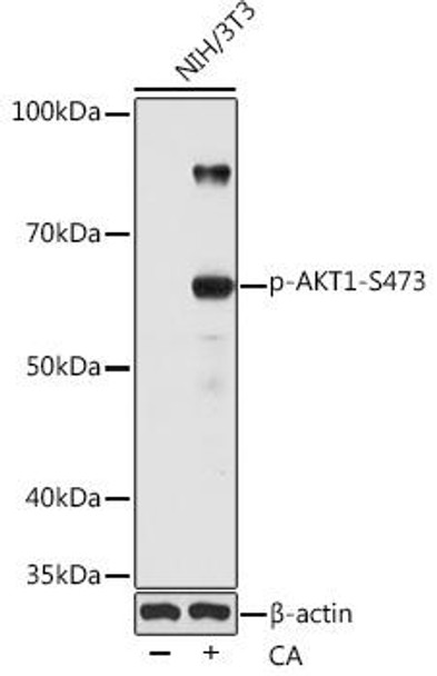 Cell Death Antibodies 2 Anti-Phospho-AKT1-S473 Antibody CABP0098