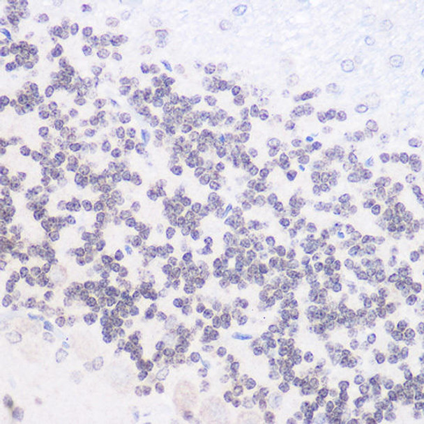 Immunology Antibodies 3 Anti-Phospho-RELA-S536 Antibody CABP0124