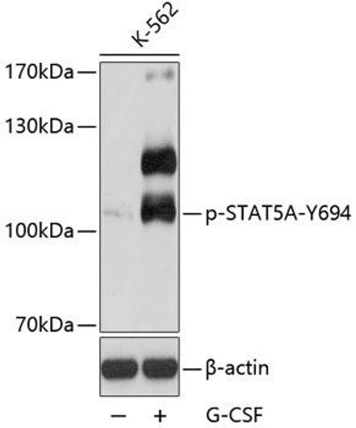 Cell Biology Antibodies 16 Anti-Phospho-STAT5A-Y694 Antibody CABP0138