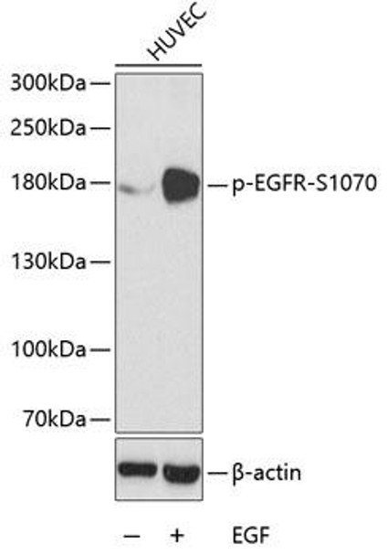 Immunology Antibodies 3 Anti-Phospho-EGFR-S1070 Antibody CABP0153