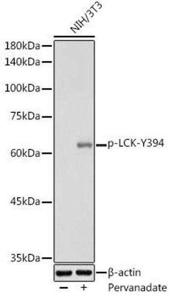 Immunology Antibodies 3 Anti-Phospho-LCK-Y394 Antibody CABP0182