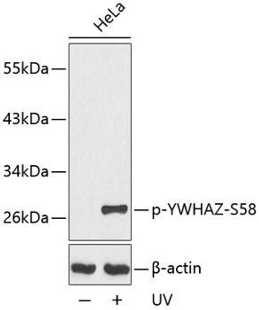 Cell Biology Antibodies 16 Anti-Phospho-YWHAZ-S58 Antibody CABP0195