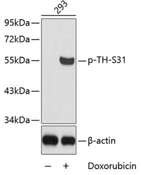 Metabolism Antibodies 3 Anti-Phospho-TH-S31 Antibody CABP0210