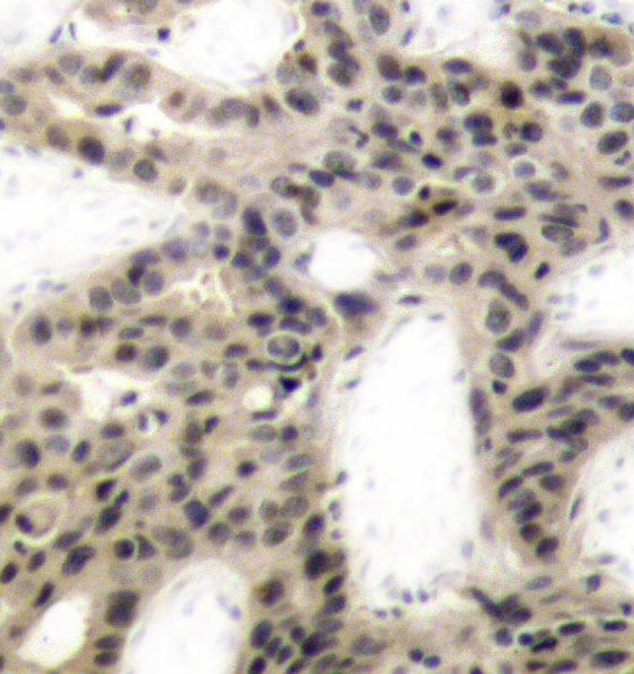 Signal Transduction Antibodies 3 Anti-Phospho-EIF4EBP1-T45 Antibody CABP0219