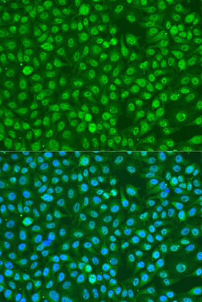 Cell Cycle Antibodies 2 Anti-Phospho-BRCA1-S1423 Antibody CABP0232