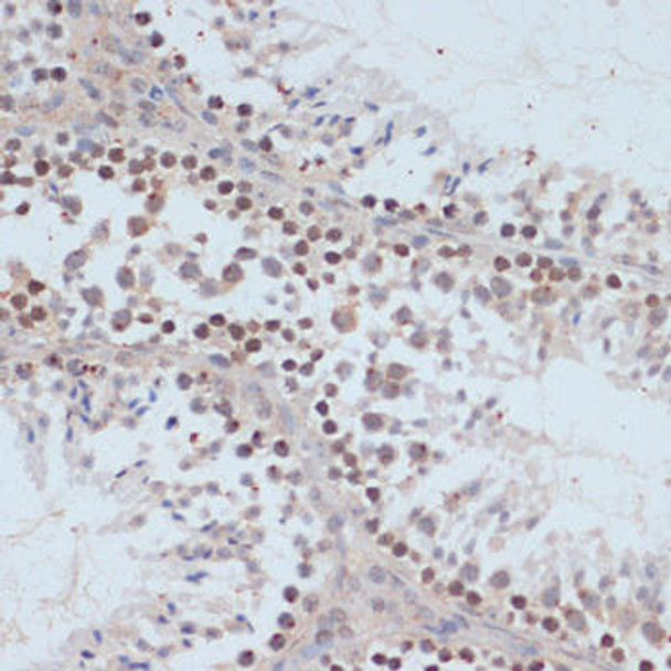 Cell Cycle Antibodies 2 Anti-Phospho-BRCA1-S1423 Antibody CABP0232