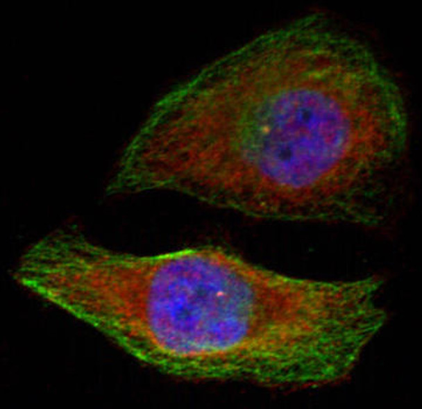 Cell Death Antibodies 2 Anti-Phospho-MAPK3-T202 Antibody CABP0234