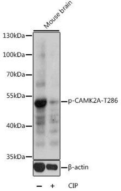 Cell Biology Antibodies 16 Anti-Phospho-Camk2a-T286 Antibody CABP0255