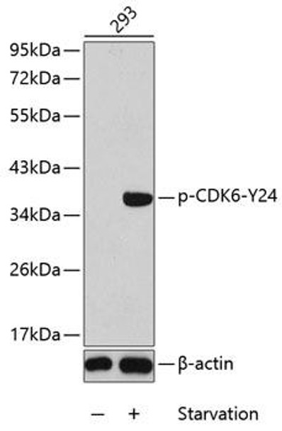 Cell Cycle Antibodies 2 Anti-Phospho-CDK6-Y24 Antibody CABP0289