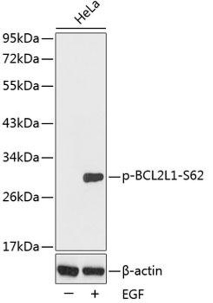 Cell Death Antibodies 2 Anti-Phospho-BCL2L1-S62 Antibody CABP0314