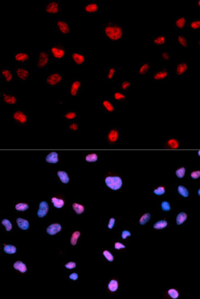 Cell Death Antibodies 2 Anti-Phospho-CDK1-T161 Antibody CABP0324