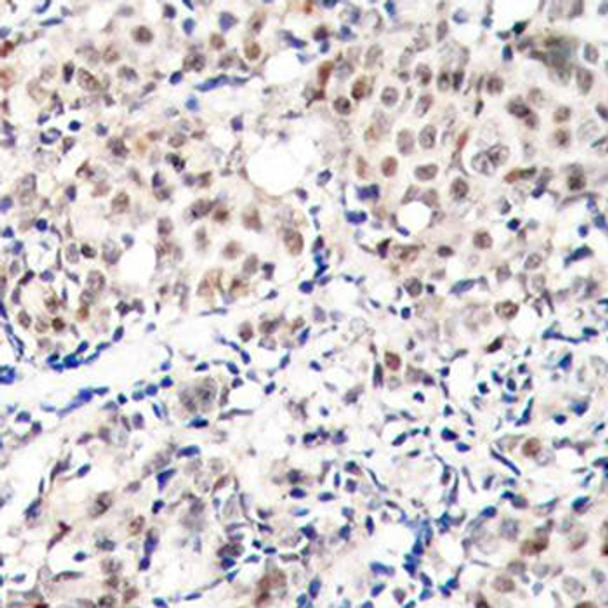 Cell Cycle Antibodies 2 Anti-Phospho-CDKN1B-T187 Antibody CABP0328