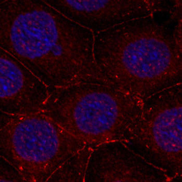 Cell Biology Antibodies 16 Anti-Phospho-IGF1R-Y1161 Antibody CABP0367