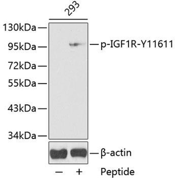 Cell Biology Antibodies 16 Anti-Phospho-IGF1R-Y1161 Antibody CABP0367