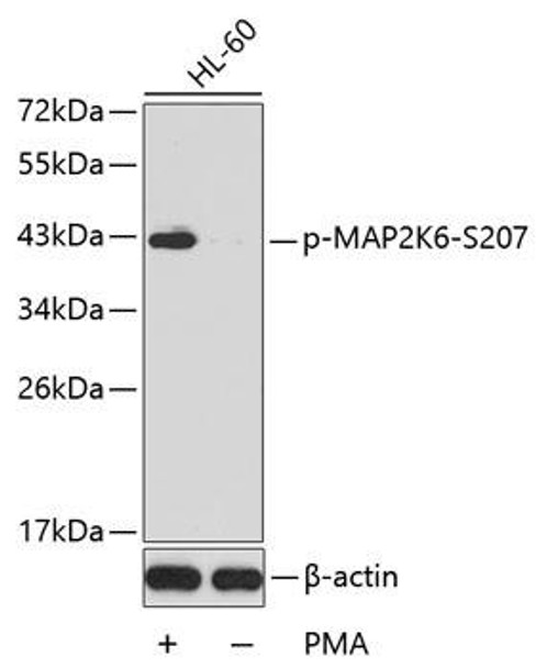 Cell Death Antibodies 2 Anti-Phospho-MAP2K6-S207 Antibody CABP0393