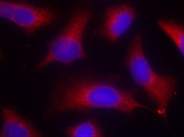 Cell Biology Antibodies 16 Anti-Phospho-MAPT-S262 Antibody CABP0397