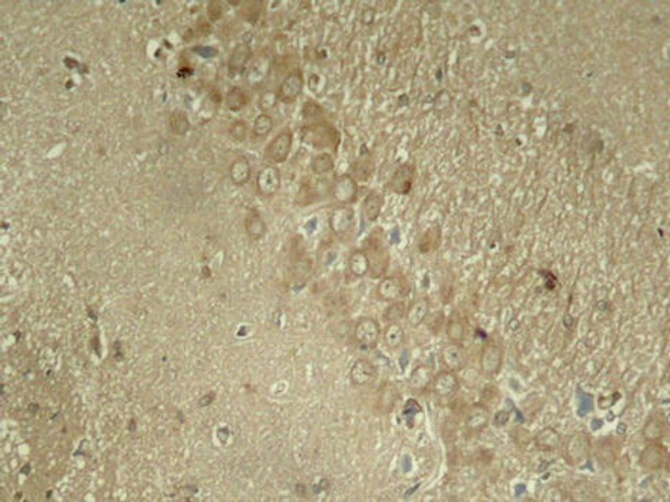 Cell Biology Antibodies 16 Anti-Phospho-MAPT-S262 Antibody CABP0397