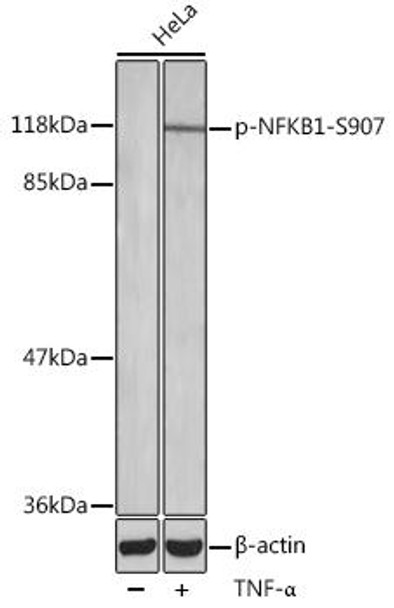 Cell Death Antibodies 2 Anti-Phospho-NFKB1-S907 Antibody CABP0416