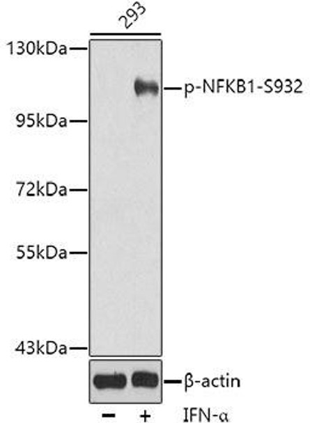 Cell Death Antibodies 2 Anti-Phospho-NFKB1-S932 Antibody CABP0417