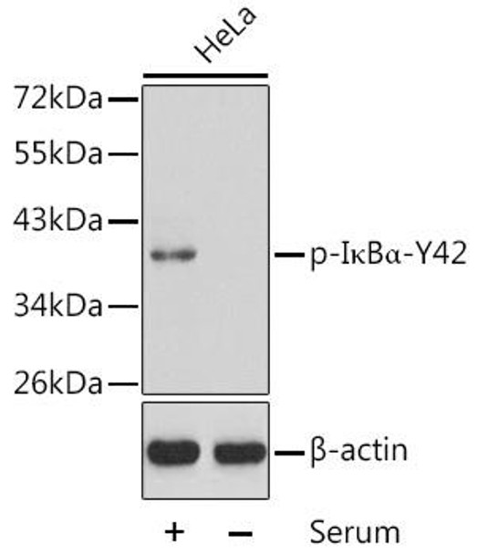 Immunology Antibodies 3 Anti-Phospho-NFKBIA-Y42 Antibody CABP0420