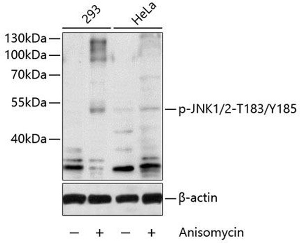 Cell Biology Antibodies 16 Anti-Phospho-JNK1/2-T183/Y185 Antibody CABP0473