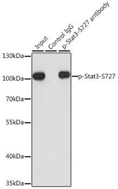 Immunology Antibodies 3 Anti-Phospho-Stat3-S727 Antibody CABP0474