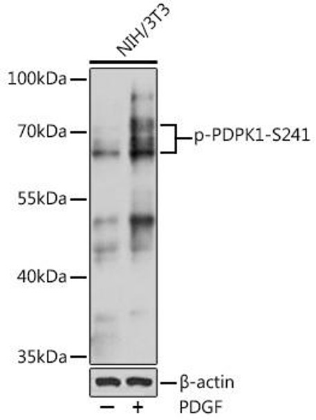 Epigenetics and Nuclear Signaling Antibodies 4 Anti-Phospho-PDK1-S241 Antibody CABP0477